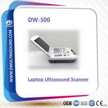 Laptop Ultrasonic Machine DW-500 Hot Sale en China con bajo precio para el embarazo y el hígado riñón del feto